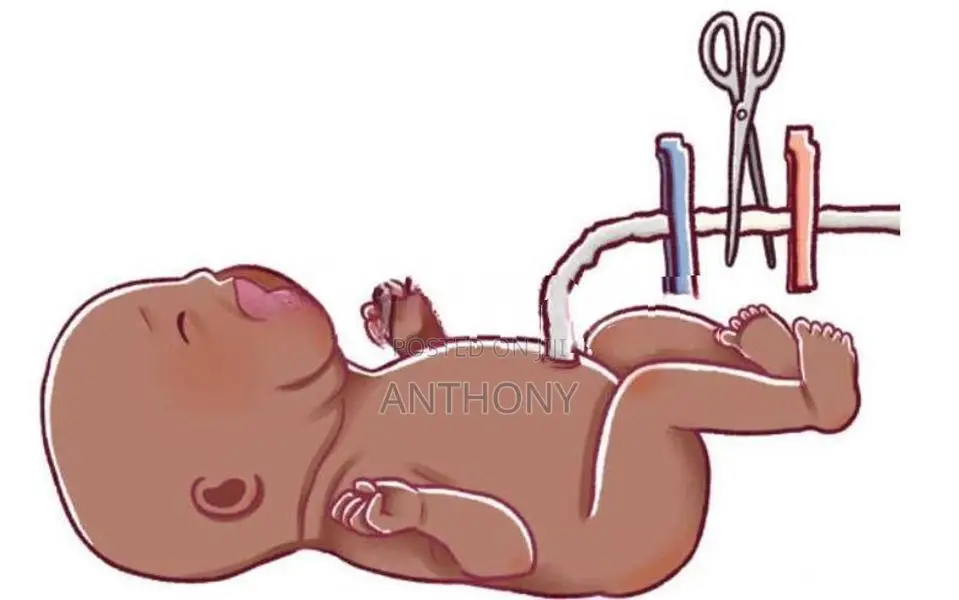 UMBILICAL CORD CLAMP